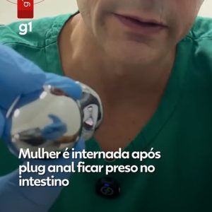 Mulher é internada após plug anal ficar preso no intestino; médicos alertam para riscos no uso do acessório