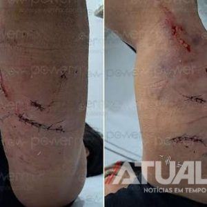 Mulher é atacada por cachorro ao tentar proteger pets e fica ferida em Nova Mutum; Veja vídeo
