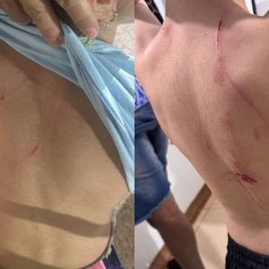 Cão da raça rottweiler é capturado após atacar crianças em praça de MT