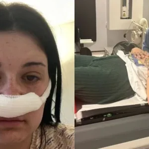 Mulher que teve sintomas tratados como estresse descobre tumor cerebral