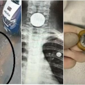Menina de 7 anos se engasga com moeda de R$ 1 e é salva por policiais