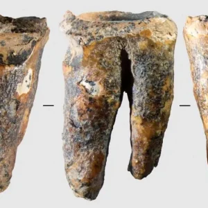 Dente em caverna da Sibéria revela cirurgia dentária pré-histórica