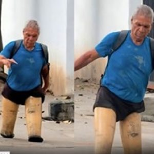 SEM ACESSO A PRÓTESES: Homem chama a atenção por improvisar as próprias pernas para sobreviver