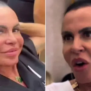 Gretchen relata complicação em tratamento contra alopecia após procedimento