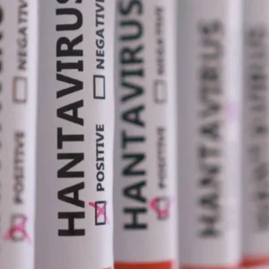 Hantavírus: países adotam protocolos próprios após casos; entenda