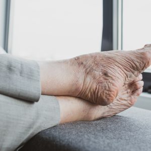 Você consegue cortar as próprias unhas dos pés?