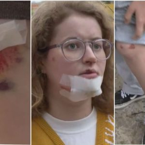 'Fiquei desesperada', diz jovem que despencou em bueiro após tampa de concreto ceder em Cuiabá