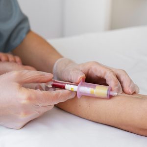Como um ‘simples’ exame de sangue pode prever risco de câncer de pulmão até 5 anos antes do diagnóstico