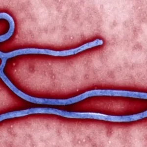 Caso suspeito de ebola é descartado em paciente no Rio Grande do Sul