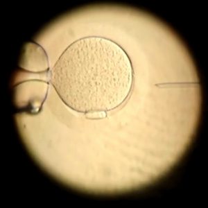 Pacientes pagam por complementos da fertilização in vitro sem evidência robusta de eficácia, diz estudo