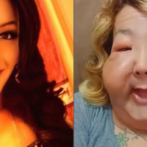 Veja antes de depois de Juju do Pix após seis meses de reconstrução facial