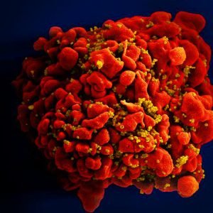 HIV: dois novos casos de cura são anunciados; total chega a 13