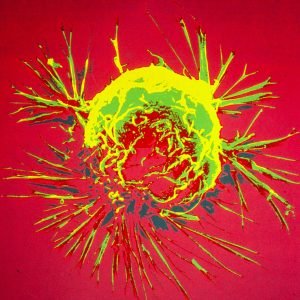 Cientistas modificam bactérias para combater câncer