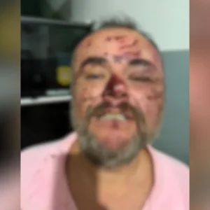 Veja imagens das supostas agressões de PMs a advogado no interior de SP