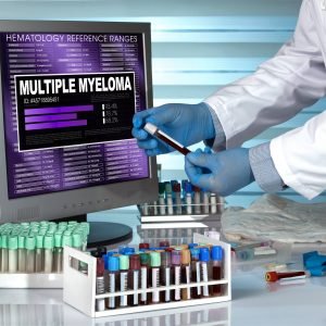 Com novos tratamentos, estudo propõe mudar critério para identificar pacientes com forma mais grave de mieloma múltiplo