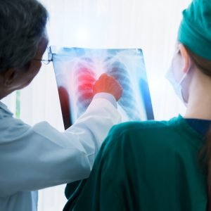 Anvisa aprova novo medicamento para câncer de pulmão