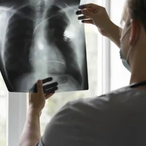 Anvisa aprova novo medicamento para câncer de pulmão com mutação genética