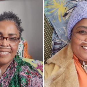 Mulher descobre doença autoimune que atrofia os pulmões após 11 anos de sintomas: ‘Me canso até para tomar banho’