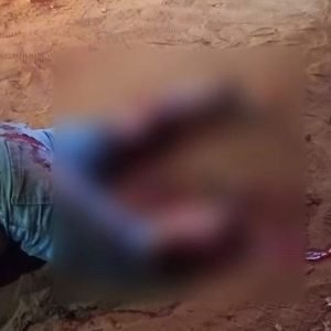 Primavera do Leste; Homem de 36 anos tem perna amputada após acidente