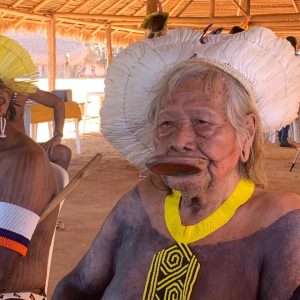 Cacique Raoni é transferido para UTI após diagnóstico de pneumotórax no pulmão direito