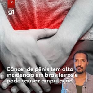 O que está levando cada vez mais homens a fazer preenchimento no pênis