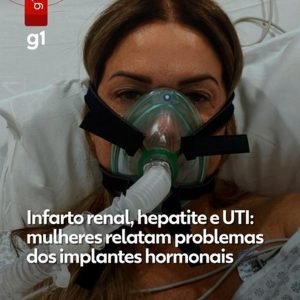 Notificações sobre testosterona em mulheres sobe e Anvisa emite alerta
