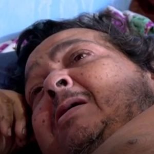 Mecânico de 230 kg morre após dois meses internado em MT