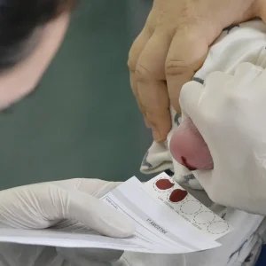 Organizações pedem mais agilidade no diagnóstico da AME no país