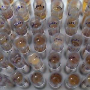 Uso de medicamento oferecido no SUS reduz casos de malária no Brasil
