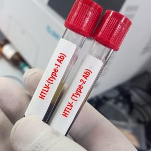 Esclerose múltipla progressiva: estudo da Fiocruz usa vírus HTLV-1