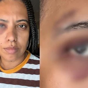 Influenciadora é agredida em samba na região central do Rio de Janeiro