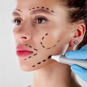 Entenda decisão que considerou ilegal norma sobre harmonização orofacial