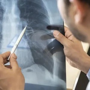 Tabagismo é maior entre jovens de 16 a 24 anos, alerta pesquisa