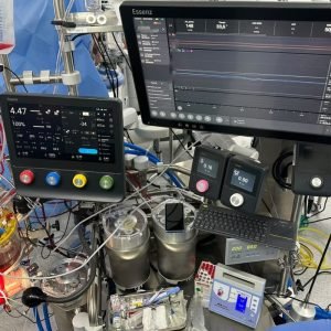 Hospital Central de MT é o 1° do país a usar novo 'aparelho coração-pulmão'