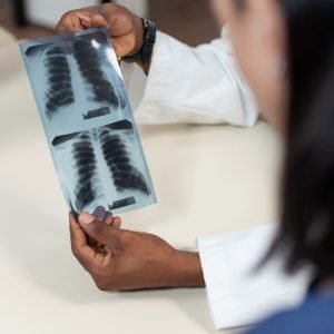 SUS vai ampliar tratamento do câncer de pulmão com três medicamentos; oferta deve começar em outubro