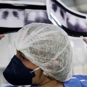 Diagnóstico tardio dá poucas chances de cura do câncer de pulmão