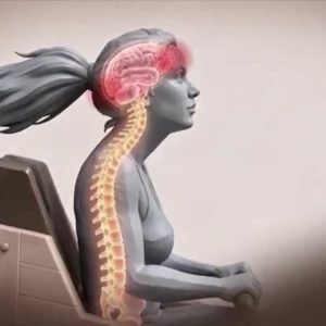 Traumatismo por 'contragolpe': entenda lesão cerebral sofrida por jovem após andar em montanha-russa