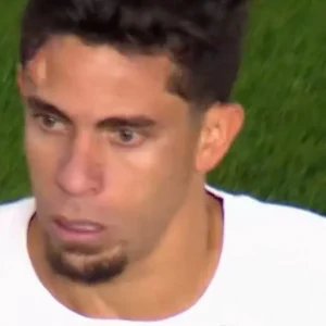 Gabriel Paulista fica com galo na testa em jogo da Libertadores