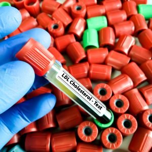 Edição genética controla colesterol alto por até um ano com dose única