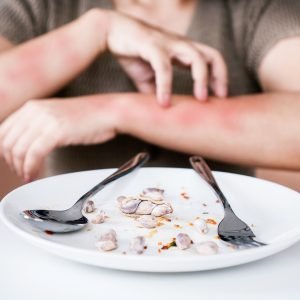 Alergia fatal: 499 mortes por reações graves no Brasil desde 2022