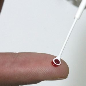 Fiji declara emergência nacional por HIV com 1 caso a cada 60 pessoas