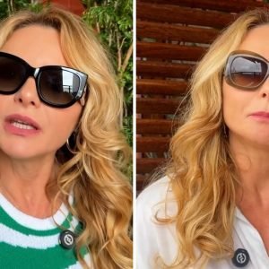 Rita Guedes relata complicações graves após blefaroplastia
