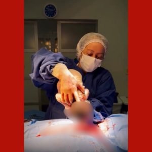 VÍDEO: bebê ‘nasce dentro de bolha’ em parto raro em MT