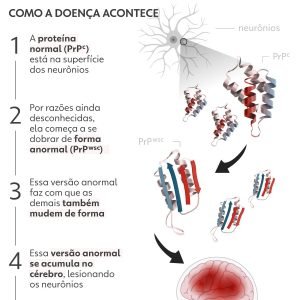 Brasil confirmou 547 casos de doença de Creutzfeldt-Jakob, de Lito Sousa, em 17 anos; São Paulo concentra 37%