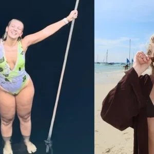 Lauren Pfeiff relata um ano de cirurgia de lipedema: “Impacto positivo”
