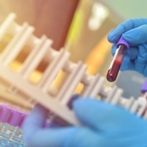 Pesquisa com mais de 28 mil pessoas descobre 'freio' que pode ser chave para novos tratamentos de doenças hereditárias do sangue