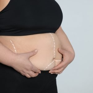 Cirurgia bariátrica: estudos revelam impactos no envelhecimento