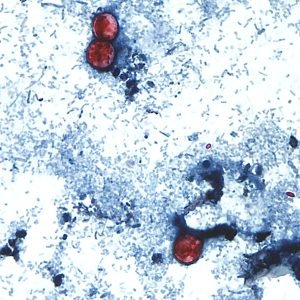 FDA encontra parasita ligado a surto de 'diarreia explosiva' que atingiu quase 13 mil pessoas nos EUA