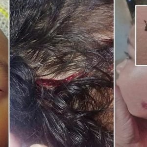 Duas crianças de 4 e 6 anos são atacadas por cães; uma sofre corte na cabeça • Olhar Direto