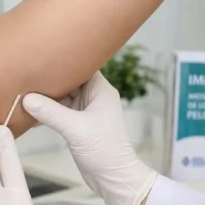Anvisa amplia para cinco anos validade do implante contraceptivo; dispositivo é distribuído no SUS